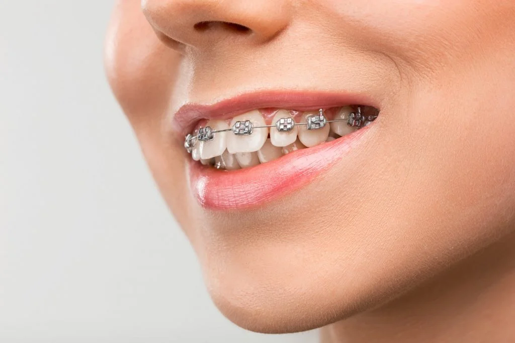 Name for Braces Doctor